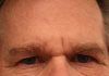 Relación entre Parkinson y depresión Psicologia parkinson y depresión